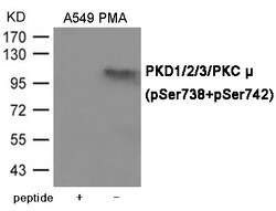 Invitrogen Phospho-PKD1/2/3/PKC mu (Ser738, Ser742) Polyclonal Antibody