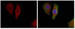 Phospho-ERK1/ERK2 (Thr202) Polyclonal Antibody:Antibodies, Polyclonal