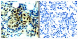 Phospho-ERK1/ERK2 (Thr202) Polyclonal Antibody:Antibodies, Polyclonal