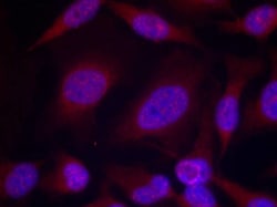 Invitrogen Phospho-JNK1/JNK2/JNK3 (Thr183, Tyr185) Polyclonal Antibody