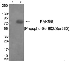 Invitrogen Phospho-PAK5/PAK6 (Ser602, Ser560) Polyclonal Antibody 100 &mu;L;