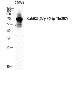 Invitrogen Phospho-CaMKII beta/gamma/delta (Thr287) Polyclonal Antibody 100 &mu;L | Buy Online | Invitrogen&trade; | Fisher Scientific