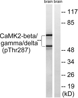 Invitrogen Phospho-CaMKII beta/gamma/delta (Thr287) Polyclonal Antibody 100 &mu;L | Buy Online | Invitrogen&trade; | Fisher Scientific