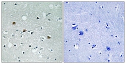 Invitrogen Phospho-LATS1/LATS2 (Thr1079, Thr1041) Polyclonal Antibody 100