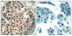 Invitrogen Phospho-HDAC4/HDAC5/HDAC9 (Ser246, Ser259, Ser220) Polyclonal