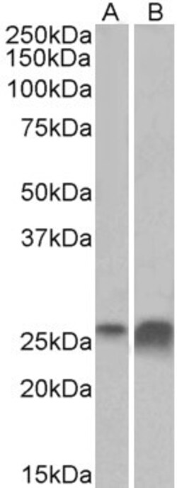 Invitrogen Apolipoprotein D Polyclonal Antibody 100 μg; Unconjugated:Antibodies,