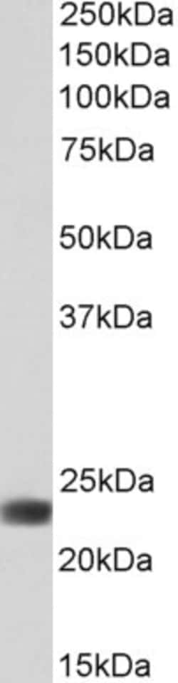 Invitrogen Flavin reductase Polyclonal Antibody 100 &mu;g; Unconjugated:Antibodies,
