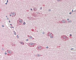 Invitrogen BMP1 Polyclonal Antibody 100 &mu;g | Buy Online | Invitrogen&trade; | Fisher Scientific