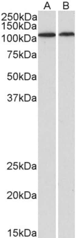 Invitrogen BMP1 Polyclonal Antibody 100 &mu;g | Buy Online | Invitrogen&trade; | Fisher Scientific
