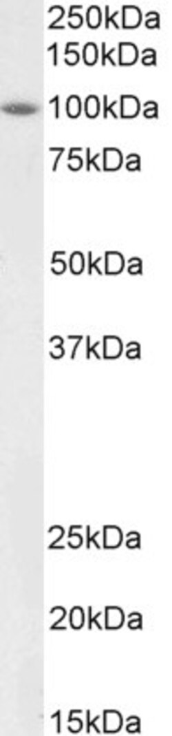 Invitrogen BMP1 Polyclonal Antibody 100 &mu;g | Buy Online | Invitrogen&trade; | Fisher Scientific