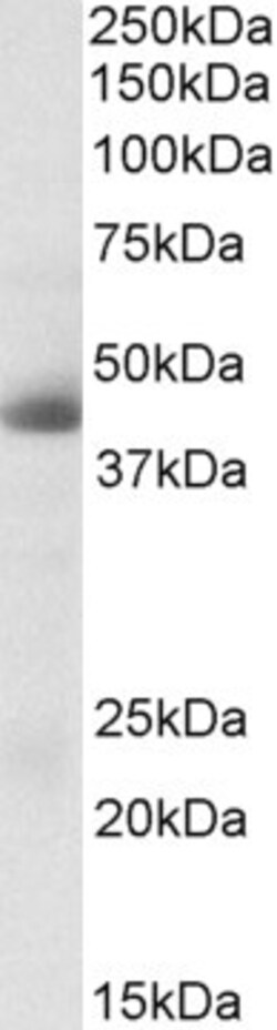 Invitrogen Carbonic Anhydrase XII Polyclonal Antibody 100 &mu;g; Unconjugated:Antibodies,
