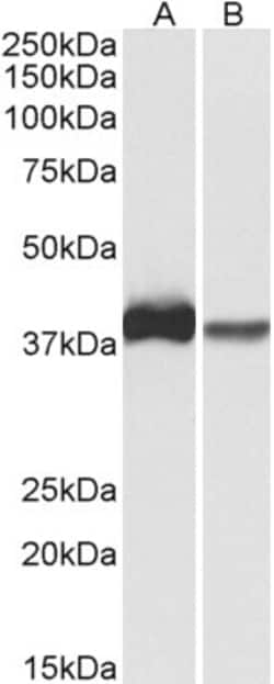 Invitrogen CAPG Polyclonal Antibody 100 &mu;g; Unconjugated:Antibodies,