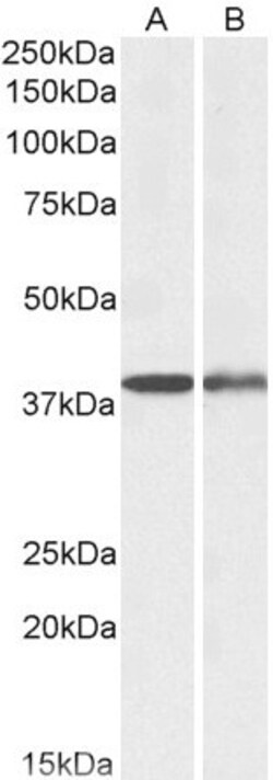 Invitrogen CAPG Polyclonal Antibody 100 &mu;g; Unconjugated:Antibodies,
