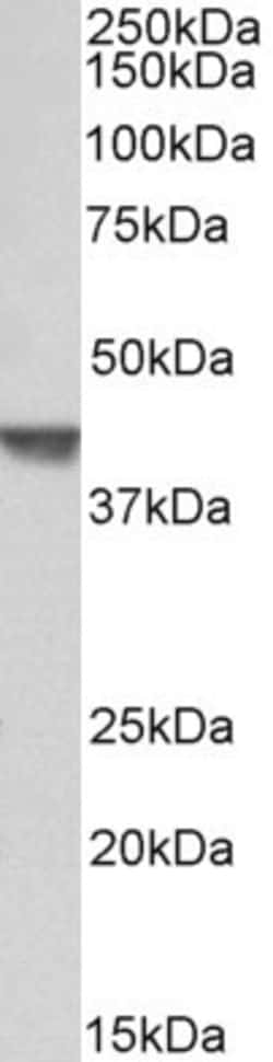 Invitrogen CAPG Polyclonal Antibody 100 &mu;g; Unconjugated:Antibodies,