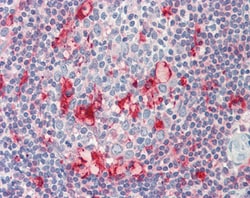 Invitrogen CAPG Polyclonal Antibody 100 &mu;g | Buy Online | Invitrogen&trade; | Fisher Scientific