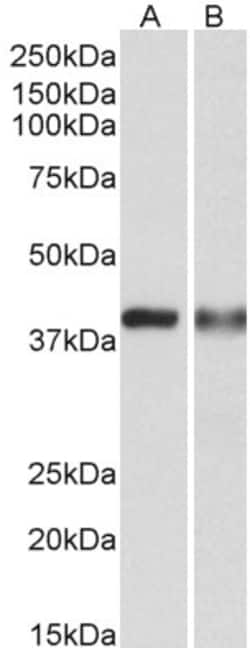 Invitrogen CAPG Polyclonal Antibody 100 &mu;g | Buy Online | Invitrogen&trade; | Fisher Scientific