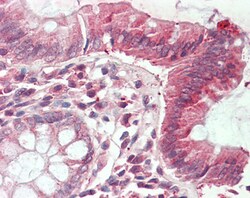 Invitrogen CLIC1 Polyclonal Antibody 100 &mu;g; Unconjugated:Antibodies,