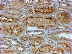 Invitrogen COL4A3 Polyclonal Antibody 100 &mu;g; Unconjugated:Antibodies,