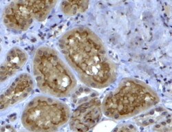 Invitrogen COL4A3 Polyclonal Antibody 100 &mu;g; Unconjugated:Antibodies,