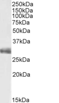 Invitrogen FGF5 Polyclonal Antibody 100 &mu;g; Unconjugated:Antibodies,