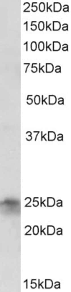 Invitrogen FGF8 Polyclonal Antibody 100 &mu;g; Unconjugated:Antibodies,