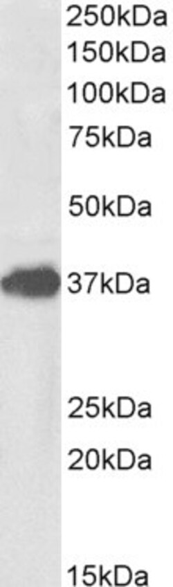 Invitrogen FOXF1 Polyclonal Antibody 100 &mu;g | Buy Online | Invitrogen&trade; | Fisher Scientific