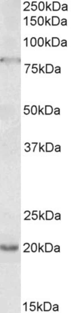 Invitrogen OAS2 Polyclonal Antibody 100 &mu;g; Unconjugated:Antibodies,