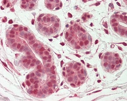 Invitrogen OAS2 Polyclonal Antibody 100 μg; Unconjugated:Antibodies,