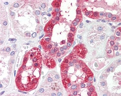 Invitrogen SLC6A8 Polyclonal Antibody 100 &mu;g; Unconjugated:Antibodies,