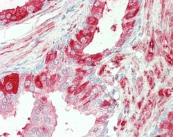 Invitrogen TGM4 Polyclonal Antibody 100 μg; Unconjugated:Antibodies,