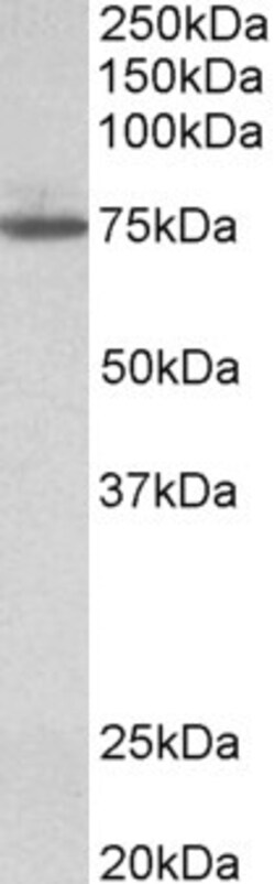 Invitrogen TGM4 Polyclonal Antibody 100 μg; Unconjugated:Antibodies,
