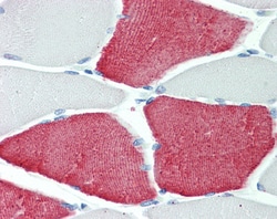 Invitrogen TNNT3 Polyclonal Antibody 100 &mu;g; Unconjugated:Antibodies,