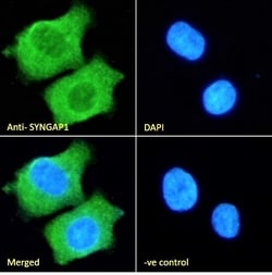 Invitrogen SynGAP Polyclonal Antibody 100 &mu;g; Unconjugated:Antibodies,