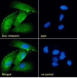 Invitrogen SynGAP Polyclonal Antibody 100 &mu;g; Unconjugated:Antibodies,