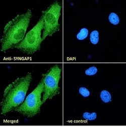 Invitrogen SynGAP Polyclonal Antibody 100 &mu;g; Unconjugated:Antibodies,