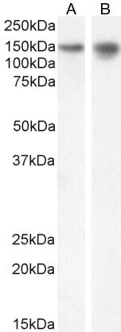 Invitrogen SynGAP Polyclonal Antibody 100 &mu;g; Unconjugated:Antibodies,