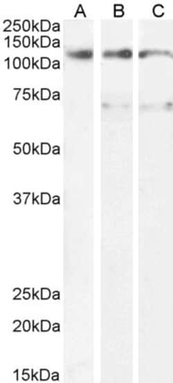 Invitrogen OSMR Polyclonal Antibody 100 &mu;g; Unconjugated:Anticuerpos