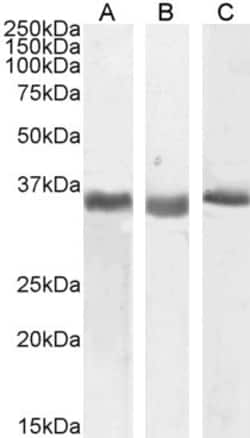 Invitrogen SPON2 Polyclonal Antibody 100 &mu;g; Unconjugated:Antibodies,