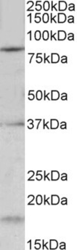 Invitrogen KV3.3 (KCNC3) Polyclonal Antibody 100 &mu;g; Unconjugated:Antibodies,