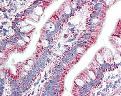 Invitrogen ZNF652 Polyclonal Antibody 100 &mu;g; Unconjugated:Antibodies,