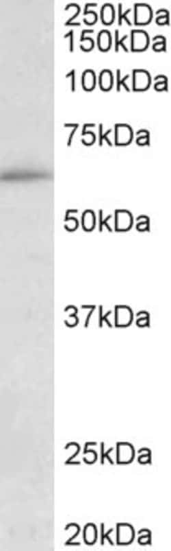 Invitrogen HIC2 Polyclonal Antibody 100 &mu;g; Unconjugated:Antibodies,