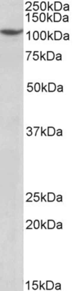 Invitrogen PRP6 Polyclonal Antibody 100 &mu;g; Unconjugated:Antibodies,