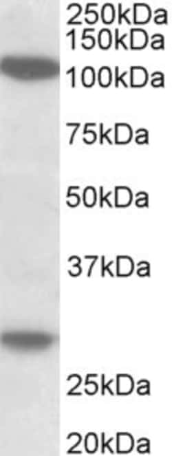 Invitrogen Ubinuclein 1/2 Polyclonal Antibody 100 &mu;g; Unconjugated:Antibodies,