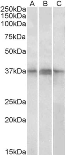 Invitrogen PHF11 Polyclonal Antibody 100 &mu;g | Buy Online | Invitrogen&trade; | Fisher Scientific