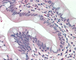 Invitrogen SLAMF8 Polyclonal Antibody 100 &mu;g; Unconjugated:Antibodies,