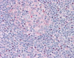 Invitrogen CTDSP1 Polyclonal Antibody 100 &mu;g | Buy Online | Invitrogen&trade; | Fisher Scientific