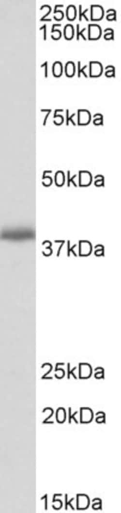 Invitrogen PDLIM2 Polyclonal Antibody 100 &mu;g; Unconjugated:Antibodies,