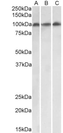 Invitrogen VPS16 Isoform 1 Polyclonal Antibody 100 &mu;g; Unconjugated:Antibodies,