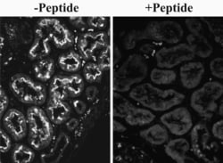 Invitrogen SLC26A6 Polyclonal Antibody 100 &mu;g; Unconjugated:Antibodies,