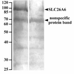 Invitrogen SLC26A6 Polyclonal Antibody 100 &mu;g; Unconjugated:Antibodies,